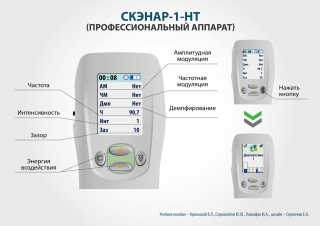 СКЭНАР-1-НТ (исполнение 01)  в Губкине купить Скэнар официальный сайт - denasvertebra.ru 